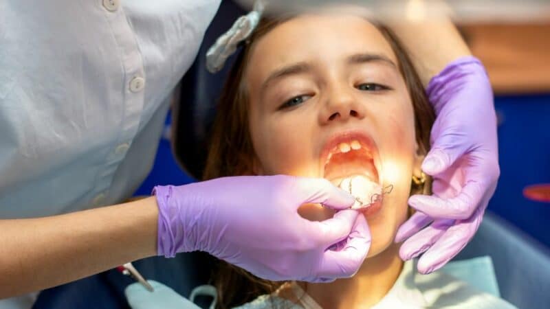 יישור שיניים פנימי